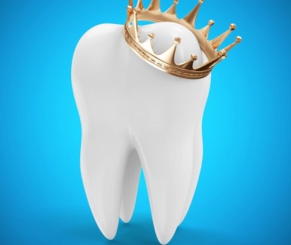 כתרי זירקוניה הם אופציה מצוינת למי שרוצה פתרון מהיר ומשתלם לבעיית שיניים